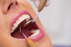 Dental Implants in India: A Great Choice for Patients Worldwide Dental Implants in India: A Great Choice for Patients Worldwide